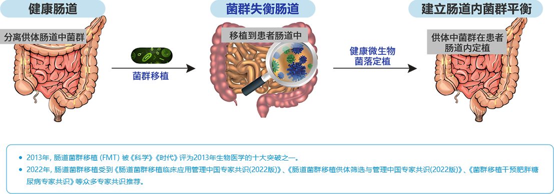 肠道菌群移植